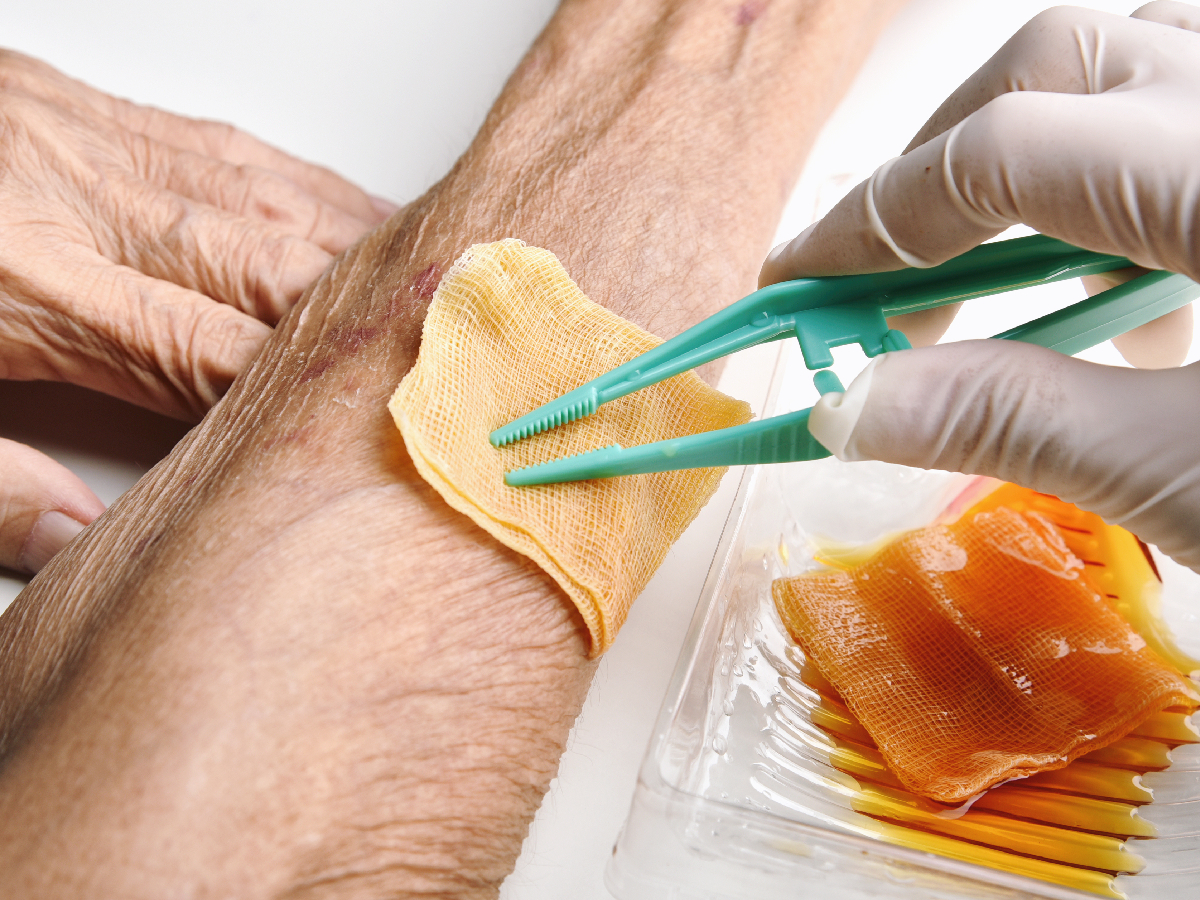 Tecnología en la medicina Descubren nueva curación de heridas Mi Casino