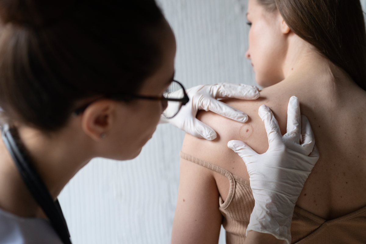 Psoriasis-y-Tratamientos_-Guia-para-sanar-y-recuperar-tu-Calidad-de-Vida-MiCasino.com